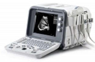 edan d6 ultrasound digital
